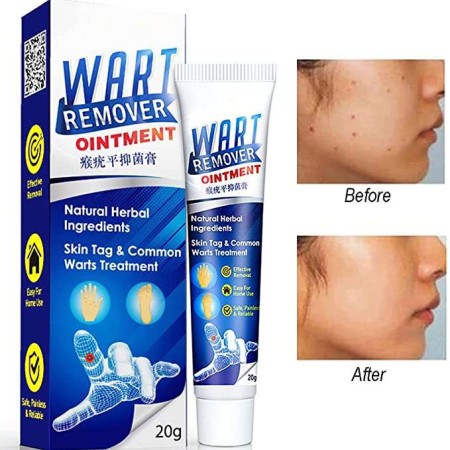 Wart Remover Skin Tag Cream (CD-178)