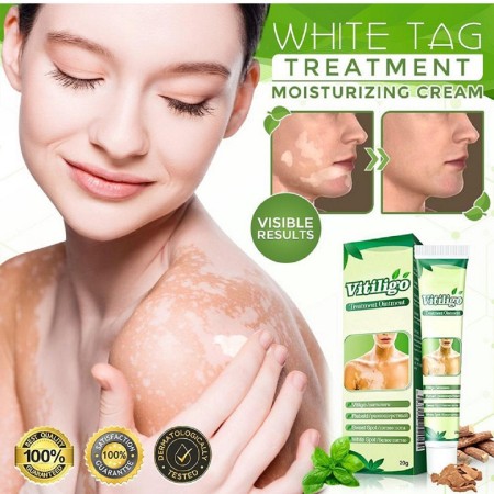 Natural white Skin Spot Care Cream