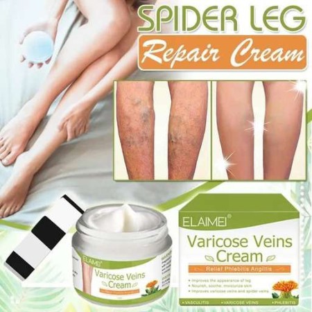 Varicose Vein Cream