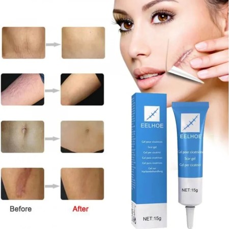 Eelhoe Gel Cote To Repair Scars 15g