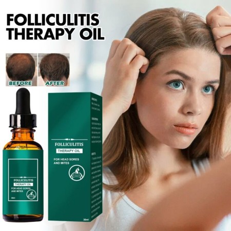 Scalp Folliculitis Therapy Oil Hair Growth Hair Loss Treatment Serum