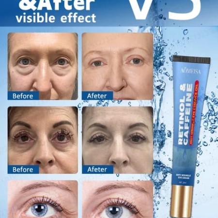 Eye Care Anti-Wrinkle Eye Cream Dark Circles Remove Eye Bags Puffy Eyes Reduce Wrinkles Fine Lines Remover Eye Fat Particles